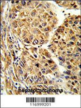 CYP2C19 Antibody (N-term)
