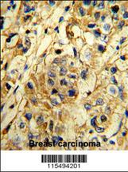 TIMP1 Antibody (N-term)
