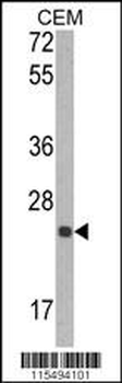 TIMP1 Antibody (N-term)