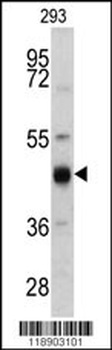 KRT13 Antibody (N-term)
