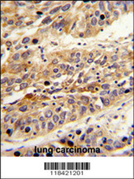 LRG1 Antibody (Center)