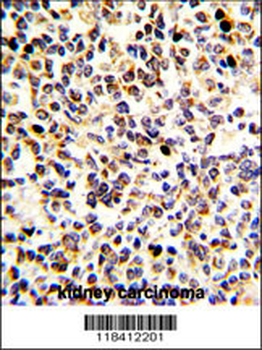 KRT10 Antibody (N-term)