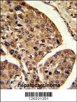PSME2 Antibody (Center)