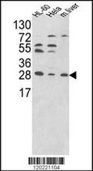 PSME2 Antibody (Center)
