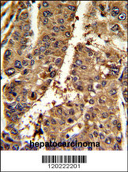 PSME2 Antibody (C-term)