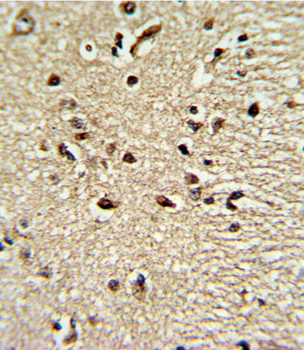 PAX4 Antibody (Center)