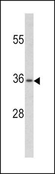 PAX4 Antibody (Center)