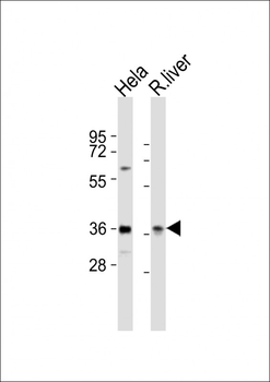 PAX4 Antibody (Center)