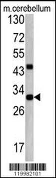 ZWINT Antibody (Center)