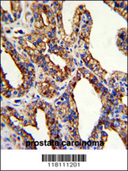 TROP2 Antibody (Center)
