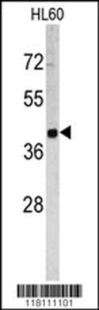 TROP2 Antibody (Center)