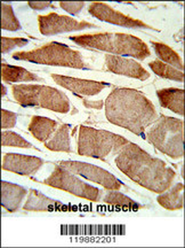 TAGLN Antibody (C-term)