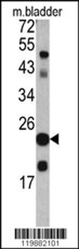 TAGLN Antibody (C-term)