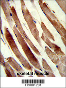 TAGLN Antibody (N-term)