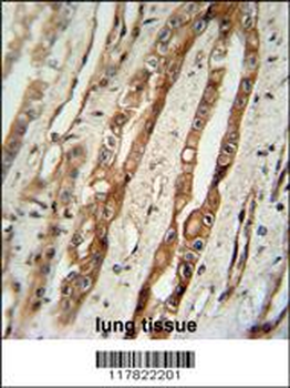 SERPING1 Antibody (Center)