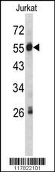 SERPING1 Antibody (Center)
