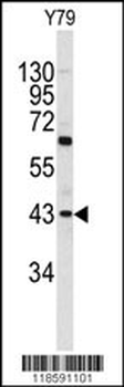 PRELP Antibody (C-term)