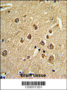 PID/MTA2 Antibody (C-term)
