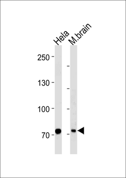 PID/MTA2 Antibody (C-term)
