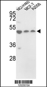 PDIA6 Antibody (Center D251)