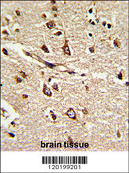 PDIA6 Antibody (Center K159)