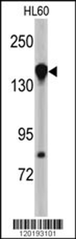 NUP155 Antibody (N-term)