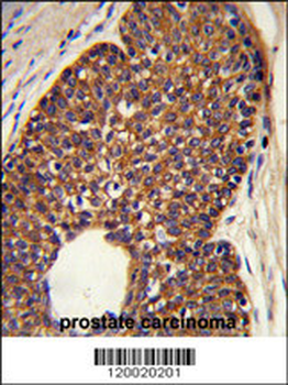 MTBP Antibody (C-term)