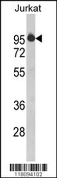 HTATSF1 Antibody (N-term)