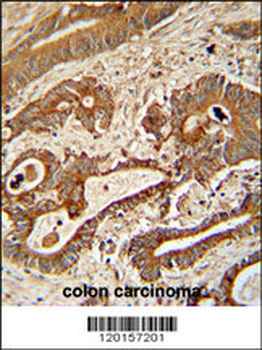 ETHE1 Antibody (Center)