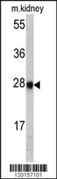 ETHE1 Antibody (Center)