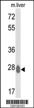 ETHE1 Antibody (C-term)