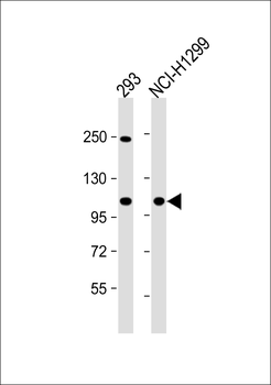 CTDP1 Antibody (N-term)