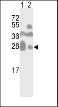 CD81 Antibody (C-term)
