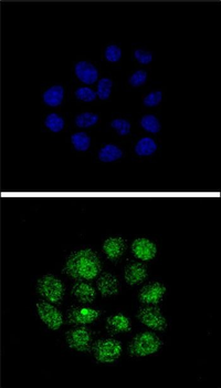 TIEG2 Antibody (N-term)