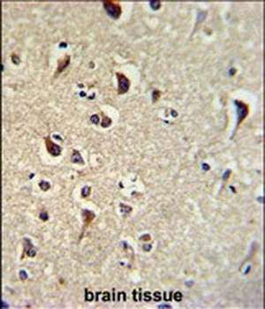 TIEG2 Antibody (N-term)