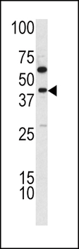 TDG Antibody (C-term)
