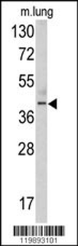 TDG Antibody (N-term)