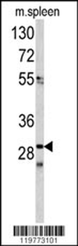 CDCA3 Antibody (N-term)