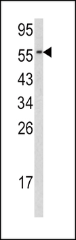 CDC23 Antibody (N-term)
