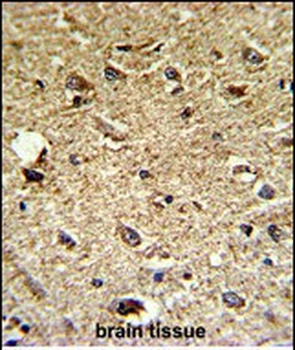 CCRN4L Antibody (C-term)