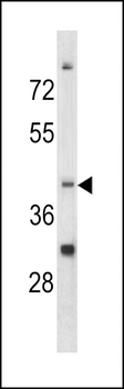 CCRN4L Antibody (C-term)