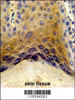 C1QTNF1 Antibody (N-term)