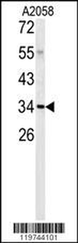 C1QTNF1 Antibody (N-term)