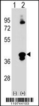 C1QTNF1 Antibody (N-term)