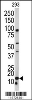 BAALC Antibody (N-term)