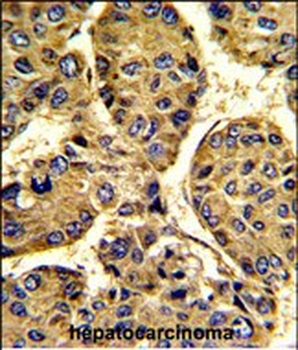 ASPN Antibody (Center)