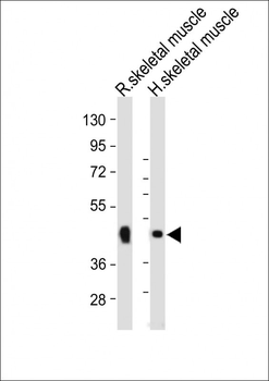 WNT10B Antibody (Center)