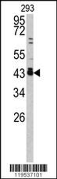 c-fos Antibody (C-term)