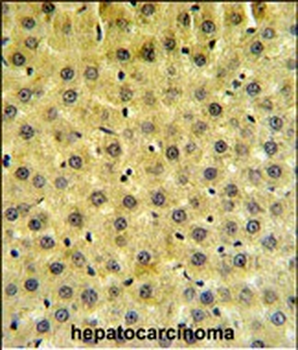 HMGCR Antibody (Center)