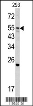 GNS Antibody (Center N189)